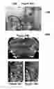 Fig. 20 - PLANNING SYSTEM FOR TARGETING TISSUE STRUCTURES WITH ULTRASOUND