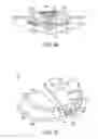 Fig. 20 - Golf club having removable weight