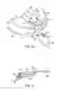 Fig. 22 - Golf club having removable weight