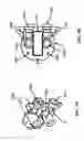 Fig. 17 - Push filter with floating key lock
