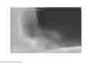 Fig. 08 - Method for preparing nano metal/metal oxide loaded molecular sieve catalyst