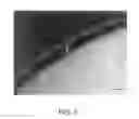Fig. 06 - Method for reinforcing die and reinforced die