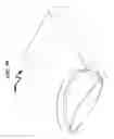 Fig. 100 - Intraocular lens (IOL) fabrication system and method