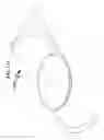 Fig. 114 - Intraocular lens (IOL) fabrication system and method
