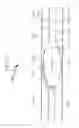 Fig. 38 - Intraocular lens (IOL) fabrication system and method