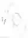 Fig. 54 - Intraocular lens (IOL) fabrication system and method