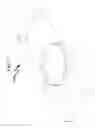Fig. 58 - Intraocular lens (IOL) fabrication system and method