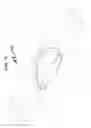 Fig. 75 - Intraocular lens (IOL) fabrication system and method