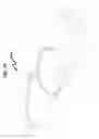 Fig. 90 - Intraocular lens (IOL) fabrication system and method