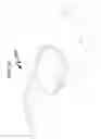 Fig. 94 - Intraocular lens (IOL) fabrication system and method