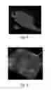 Fig. 05 - Method Of Making Nonwoven Material Having Discrete Three-Dimensional Deformations With Wide Base Openings That are Tip Bonded to Additional Layer