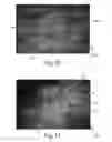 Fig. 11 - Method Of Making Nonwoven Material Having Discrete Three-Dimensional Deformations With Wide Base Openings That are Tip Bonded to Additional Layer