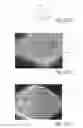 Fig. 17 - Method Of Making Nonwoven Material Having Discrete Three-Dimensional Deformations With Wide Base Openings That are Tip Bonded to Additional Layer