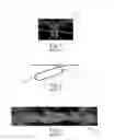 Fig. 02 - Method Of Making Nonwoven Material Having Discrete Three-Dimensional Deformations With Wide Base Openings That are Base Bonded to Additional Layer