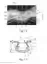 Fig. 07 - Method Of Making Nonwoven Material Having Discrete Three-Dimensional Deformations With Wide Base Openings That are Base Bonded to Additional Layer