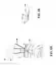 Fig. 04 - Devices and methods for connecting a spoke to a hub