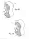 Fig. 08 - Collapsible wheels and methods of making collapsible wheels