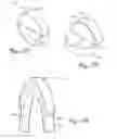 Fig. 15 - Collapsible wheels and methods of making collapsible wheels