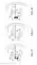 Fig. 05 - METHOD AND ASSEMBLY FOR BATTERY MAINTENANCE