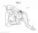 Fig. 02 - Device for operating vehicular parking brake