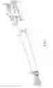 Fig. 02 - Slack adjuster having a one piece housing