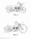 Fig. 02 - Steering shaft modifier