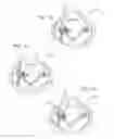 Fig. 10 - Lid for container