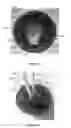 Fig. 19 - Lid for container