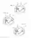 Fig. 10 - Lid for container