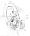 Fig. 13 - Portable self-locking lift system