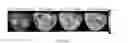 Fig. 04 - COMPOSITIONS AND METHODS FOR CHEMICAL EXCHANGE SATURATION TRANSFER (CEST) MAGNETIC RESONANCE IMAGING (MRI)