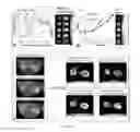 Fig. 06 - COMPOSITIONS AND METHODS FOR CHEMICAL EXCHANGE SATURATION TRANSFER (CEST) MAGNETIC RESONANCE IMAGING (MRI)