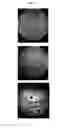 Fig. 04 - Fluorinated integrin antagonists