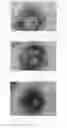 Fig. 07 - Anti-angiogenesis compound, intermediate and use thereof