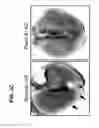 Fig. 11 - B-TYPE PLEXIN ANTAGONISTS AND USES THEREOF