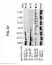Fig. 23 - B-TYPE PLEXIN ANTAGONISTS AND USES THEREOF