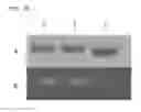 Fig. 26 - ALBUMIN VARIANTS