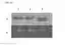 Fig. 26 - ALBUMIN VARIANTS