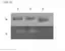 Fig. 26 - ALBUMIN VARIANTS