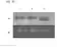 Fig. 26 - ALBUMIN VARIANTS