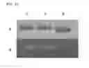 Fig. 26 - ALBUMIN VARIANTS