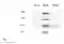 Fig. 02 - ADJUVANT THERAPY FOR STAPHYLOCOCCAL INFECTION WITH ENTEROTOXIN SPECIFIC MABS