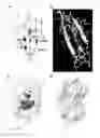 Fig. 11 - ADJUVANT THERAPY FOR STAPHYLOCOCCAL INFECTION WITH ENTEROTOXIN SPECIFIC MABS