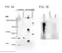 Fig. 02 - Methods for treating neoplasia