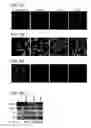 Fig. 06 - Methods for treating neoplasia