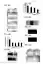 Fig. 07 - Methods for treating neoplasia