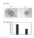 Fig. 08 - Methods for treating neoplasia
