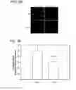 Fig. 10 - Methods for treating neoplasia
