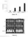 Fig. 10 - CS1-specific chimeric antigen receptor engineered immune effector cells