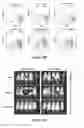 Fig. 14 - CS1-specific chimeric antigen receptor engineered immune effector cells